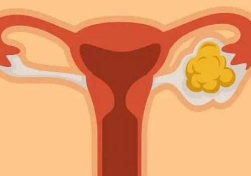 厦门二胎高龄孕前检查项目表，这三个检查必须重视