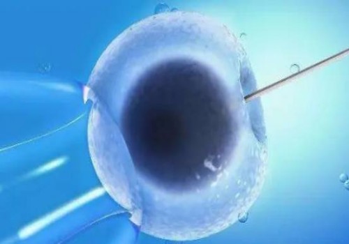 男方染色体异常三代试管是首选，让下一代更健康